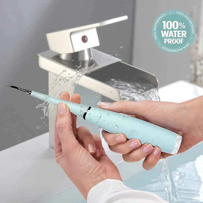 SonicSmile Pro Tartar Cleaner